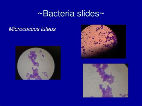 Micrococcus luteus antibiotic treatment