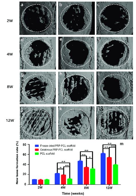 Evaluation of bone formation in calvarial defects via micro-CT.... | Download Scientific Diagram