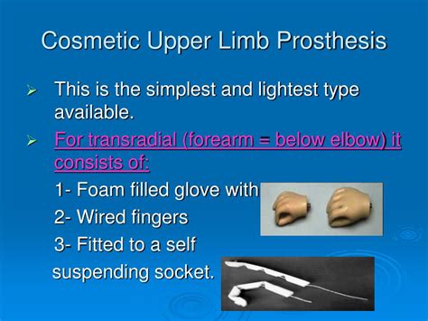 PPT - Upper and lower limb prosthesis PowerPoint Presentation, free download - ID:5526708