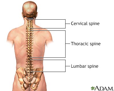 Lumbosacral spine x-ray Information | Mount Sinai - New York