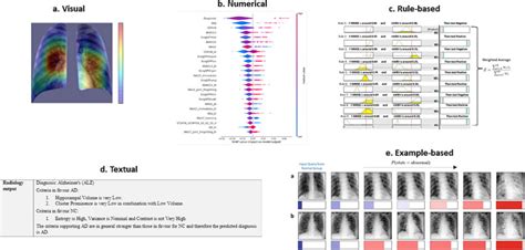 Review article on XAI in medical imaging – MedGIFT