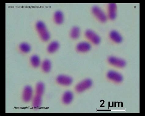 Haemophilus influenzae Gram stain. Haemophilus influenzae micrograph ...