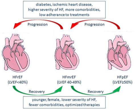 What is Congestive Heart Failure - Stages, Causes, Signs, Symptoms