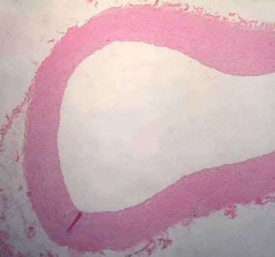 Vessels Histology - Aorta - histology slide