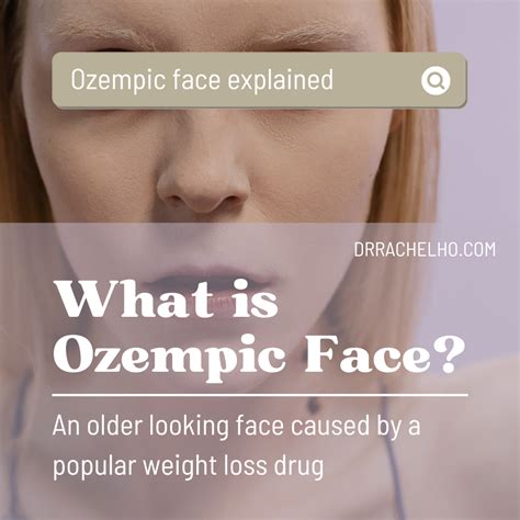 Dr Rachel Ho | What is Ozempic Face? An Alarming Side Effect of A ...