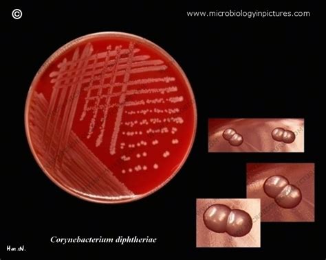 Corynebacterium diphtheriae on blood agar. C.diphtheriae growing on blood agar in Petri dish. C ...