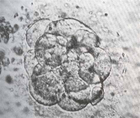 Carnegie Stage 2-9 – Morula at the beginning of compaction