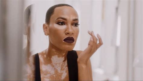 CoverGirl Taps Amy Deanna As Their Latest Model, And The First With Vitiligo | [site:name] | Essence