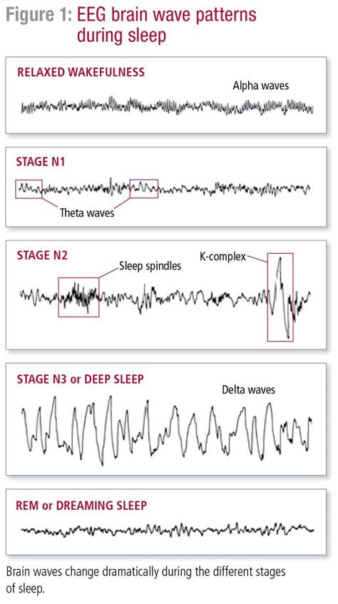 Brain wave patterns during sleep | Brain waves, Stages of sleep, Sleep ...