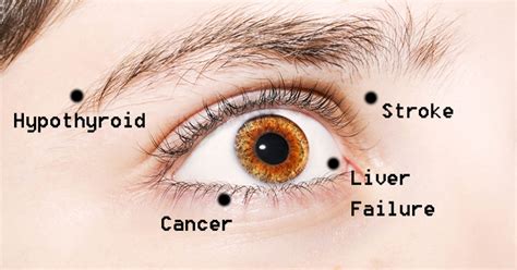 8 Eye Problems That May Actually Indicate Disease