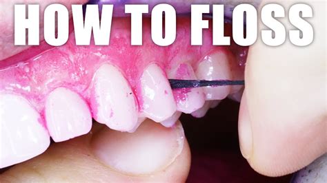 Dentist Shows HOW TO FLOSS YOUR TEETH PROPERLY: Correct Dental Flossing ...