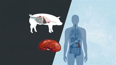 Is it okay to harvest pig kidneys for human transplant? - Vox