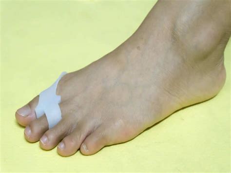 Clubbing of toes and fingers: LUNG CANCER or HEART DISEASE