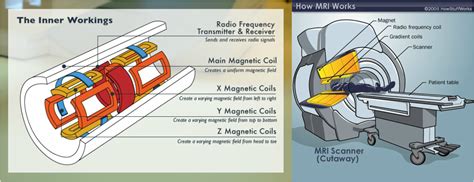 How Does MRI Work? - MRI