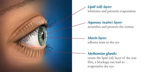 Dry Eye Treatment | In2Eyes Optometry