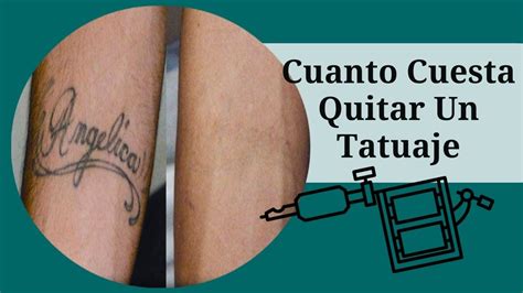 Cuanto Cuesta Quitar Un Tatuaje, Como Borrar Un Tatuaje En Casa, http ...