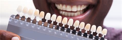 What the color of your teeth says about you - Delta Dental