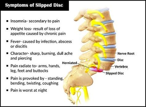 Lower Back Pain Treatment > doctor Dwight Aged Bone