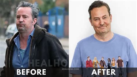 Matthew Perry Weight Loss [2023]: Before and After - KLBFit