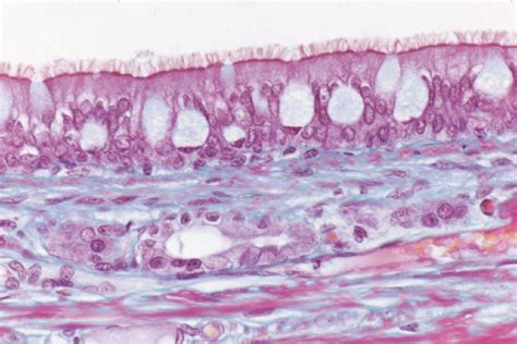 Pseudostratified, Ciliated, Columnar Epithelium Slides | VWR