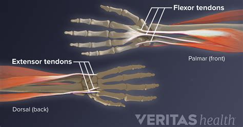 Wrist Tendonitis: An Overview