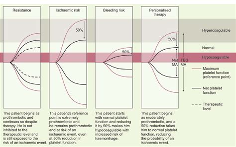 A Review of Thromboelastography | Semantic Scholar