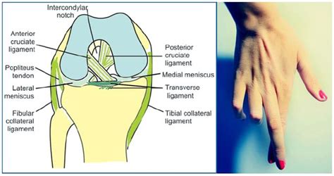 Cruciate ligaments of Knee : Mnemonics | Epomedicine