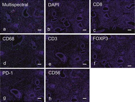 Multiplex immunofluorescence and automated image analysis to measure ...