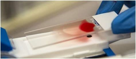 Blood Group Testing- An experiment to determine the blood group