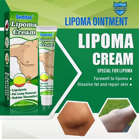 Sumifun Lipoma Removal Cream Lipolysis, Fat Lump Removal Cream （20g ...