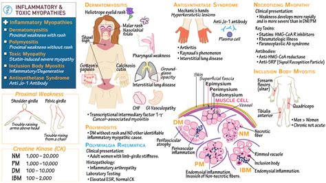 USMLE / COMLEX - Step 1: Dermatomyositis & Polymyositis | ditki medical & biological sciences