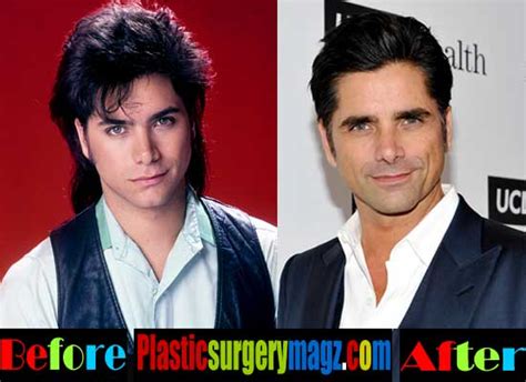 John Stamos Plastic Surgery Before and After | Plastic Surgery Magazine