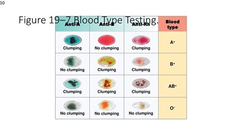 Blood Type Testing Diagram | Quizlet