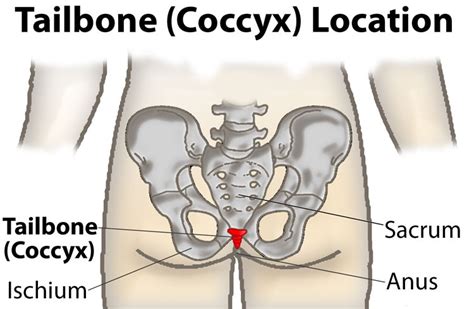 Tailbone (Coccyx) Injury – Fitnessology