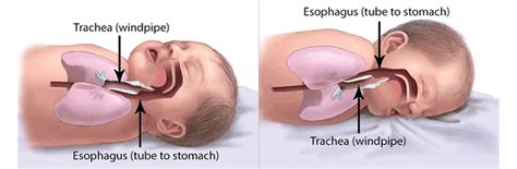 Research on Back Sleeping And SIDS | Safe to Sleep