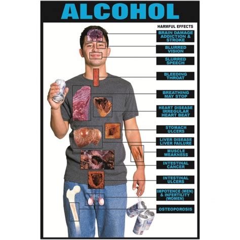 Medical Consequences of Alcohol Abuse