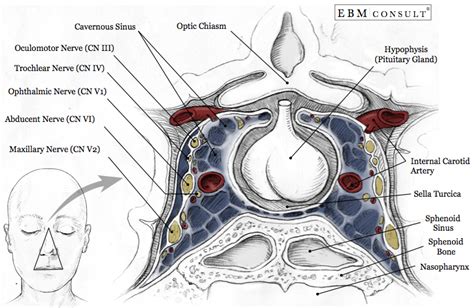 Sphenoid Sinus And Cavernous Sinus