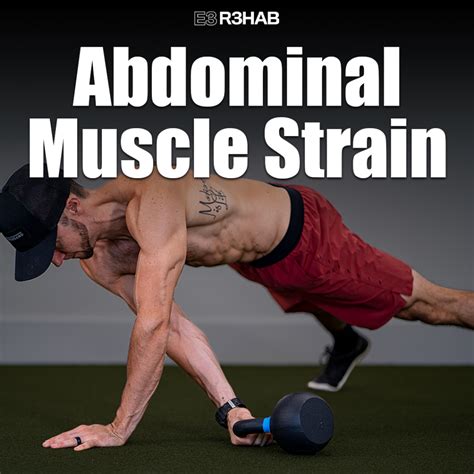 Abdominal Muscle Strain - E3 Rehab