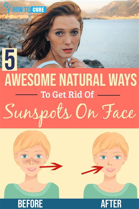 5 Wondrous Natural Ways for How to Get Rid of Sunspots on Face [Video ...