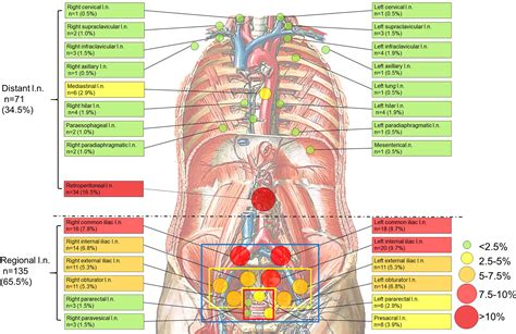 Retroperitoneal Lymph Nodes Anatomy