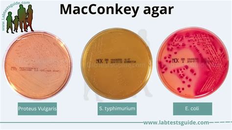 MacConkey Agar: Composition, Principle, Uses, And Procedure, 57% OFF