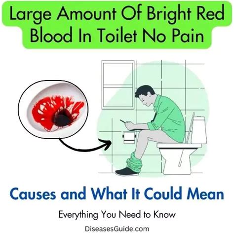 abdominal pain and blood in stool female - Diseases Guide