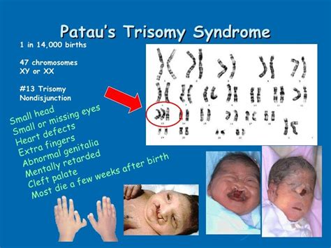 Biochem chromosomal disorders