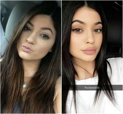 Kylie Jenner's Lips - Before and After Pictures of Her Pout