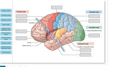 Solved Auditory cortex Frontal Lobe Parietal Lobe Prefrontal | Chegg.com