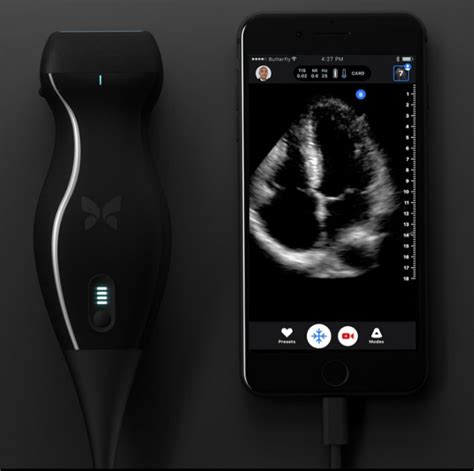 Butterfly iQ Multi-Purpose Pocket-Sized Ultrasound Now Available in ...