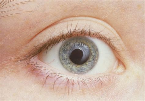 Human eye showing dilated pupil - Stock Image - P420/0002 - Science Photo Library