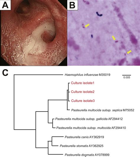 Pasteurella Multocida Human Infection