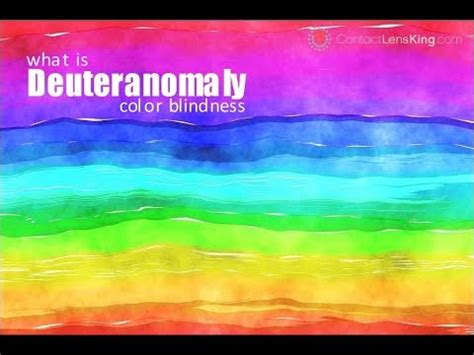 Deuteranomaly Color Blindness - YouTube