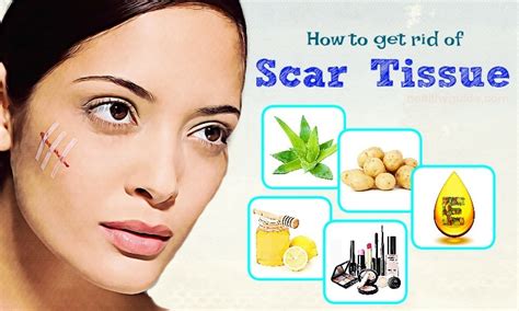 How To Get Rid Of Scar Tissue On Face And Lip- Top 28 Simple Methods